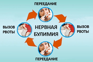 Лечение булимии в Дедеркое